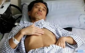 Người đàn ông 53 tuổi mắc ung thư gan, bác sĩ tức giận: Đừng làm việc này quá 3 lần 1 tháng